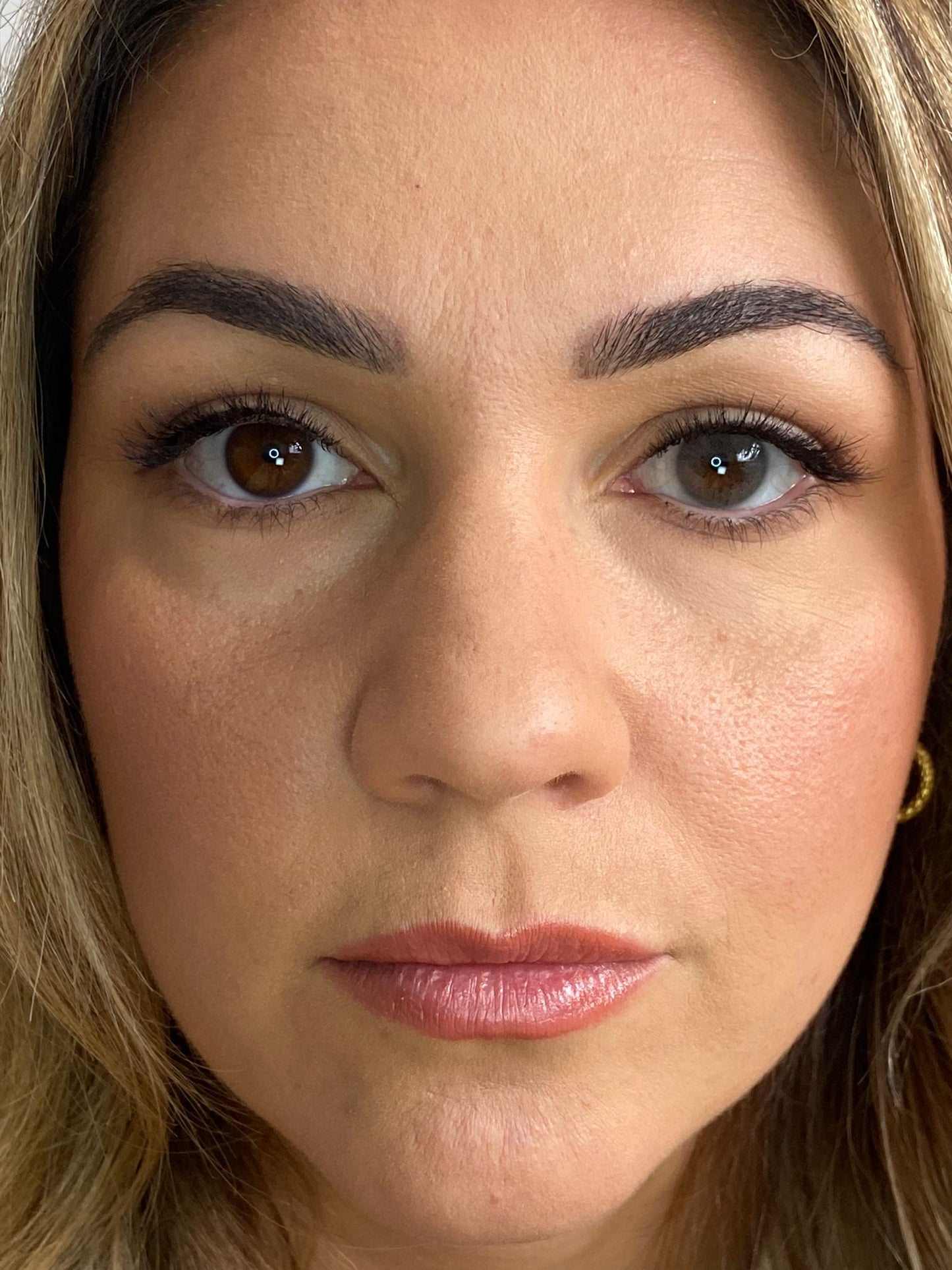 VENICOL contact lenses
